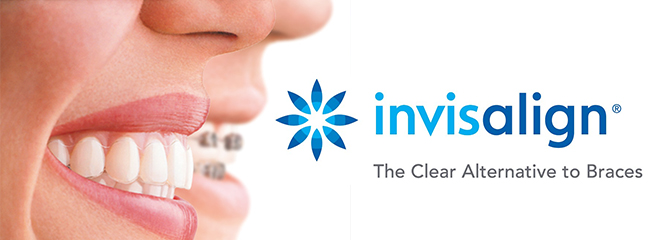 invisalign clear braces aligners